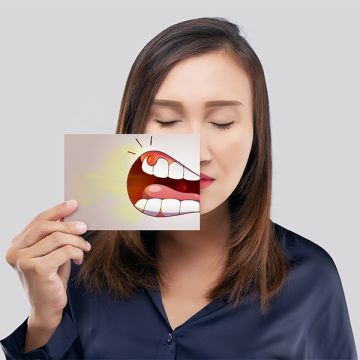 Can Gum Grafts Prevent Tooth Loss? Understanding the Long-Term Benefits